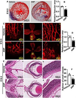 Andrographolide suppresses hypoxia-induced embryonic hyaloid vascular system development through HIF-1a/VEGFR2 signaling pathway